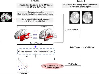 Stable functional compensation within hippocampal-subregion networks in patients with temporal glioma before and after surgery